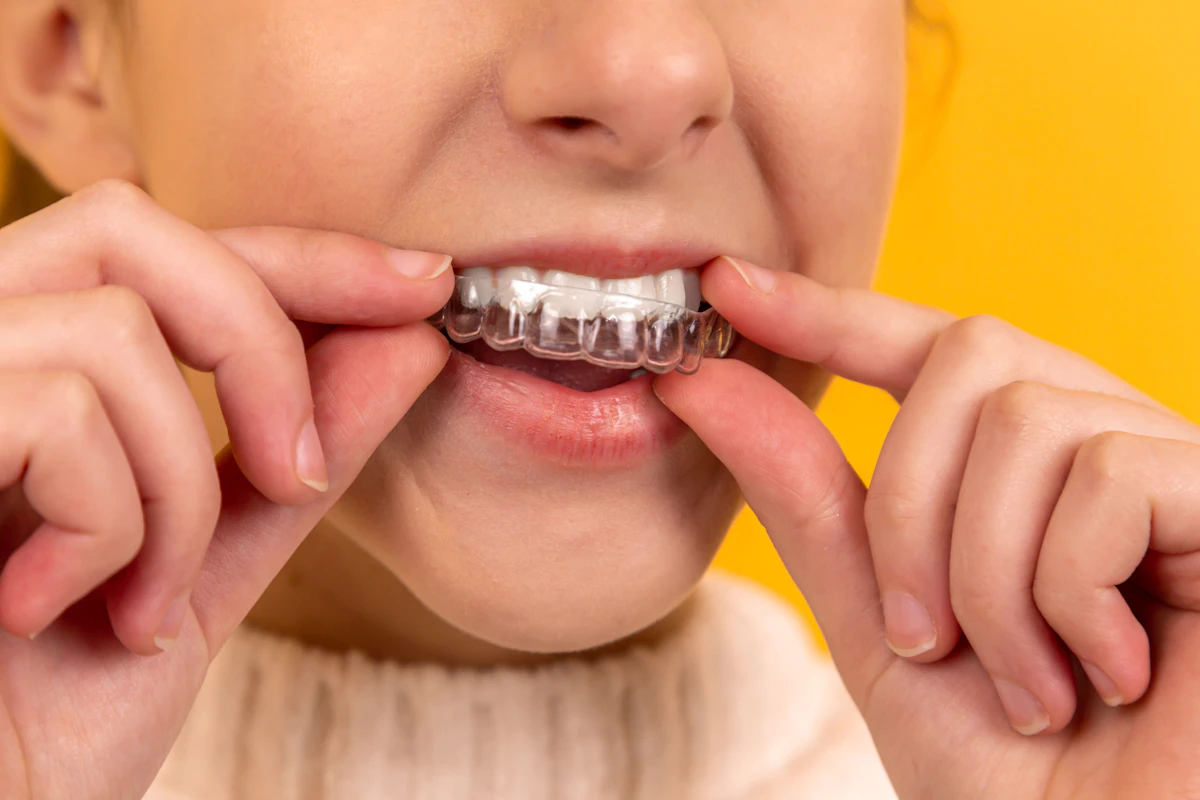 Ambulatori odontoiatrici accreditati per cure dentali in provincia di Brindisi